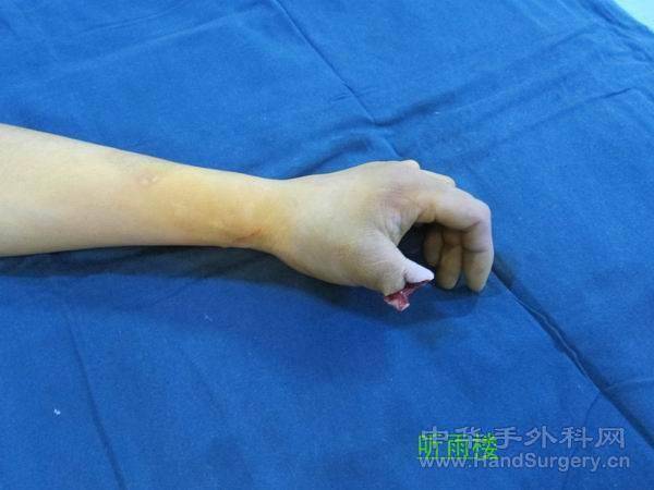 223956iix2vap7fvvcvday.jpg.thumb[1].jpg
