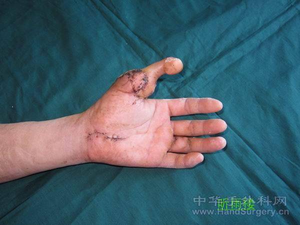 224000t0bewee7ii0t1pbr.jpg.thumb[1].jpg