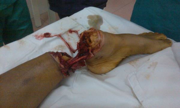 IMG_20110813_162032.jpg