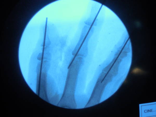 DSCN9665.JPG