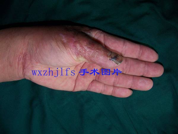 100_9726.JPG