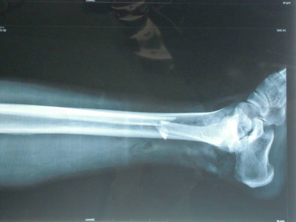 DSCN8238.JPG