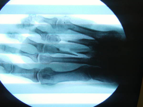 FILE2852.JPG