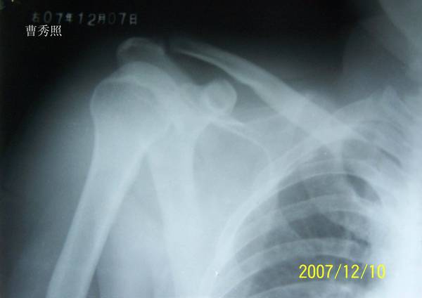 02.JPG