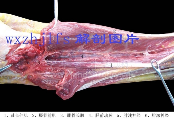 100_1179.JPG