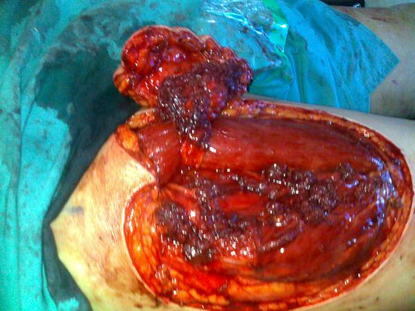 20110824018.jpg