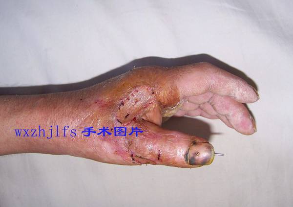100_9486.JPG