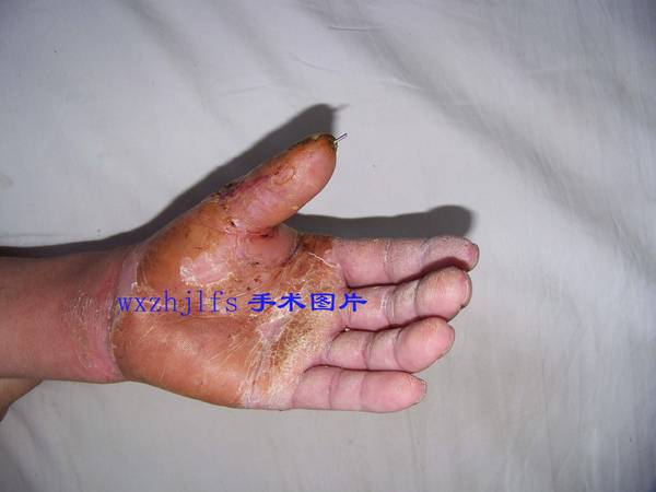 100_9491.JPG