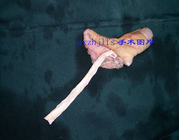 100_9026.JPG