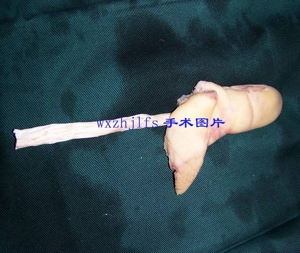 100_9028.JPG