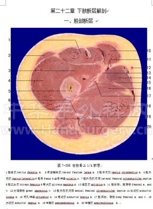 右股骨上四分之一断层.jpg