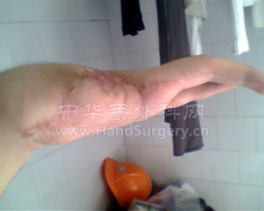 手术后现在的