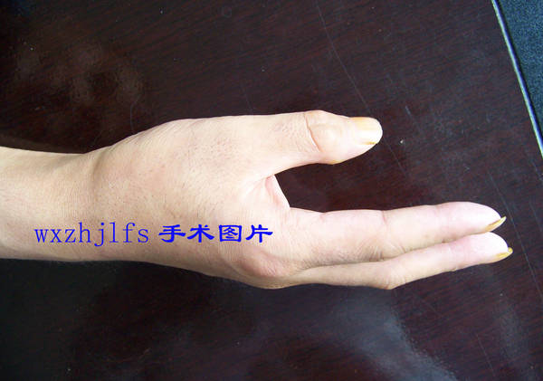 100_8277.JPG