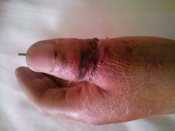 IMG_20110829_083102.jpg