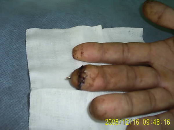 SUC53583.JPG