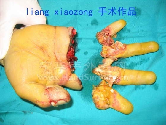 周信柳2 拷贝.jpg