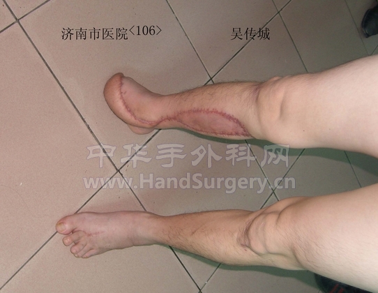 可以行走