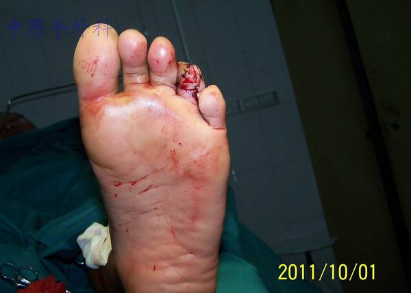 100_5754.jpg