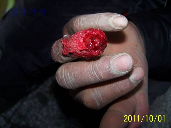 100_5755.jpg