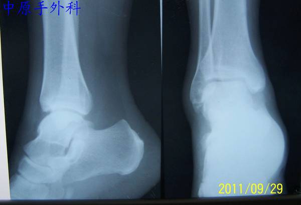 100_570.jpg