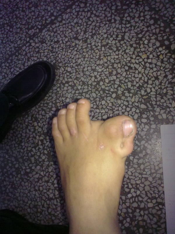 照片