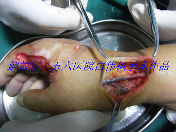 DSCF9337.JPG