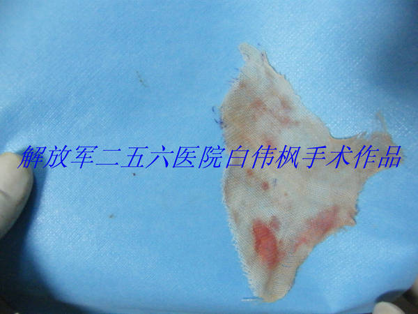 DSCF9339.JPG