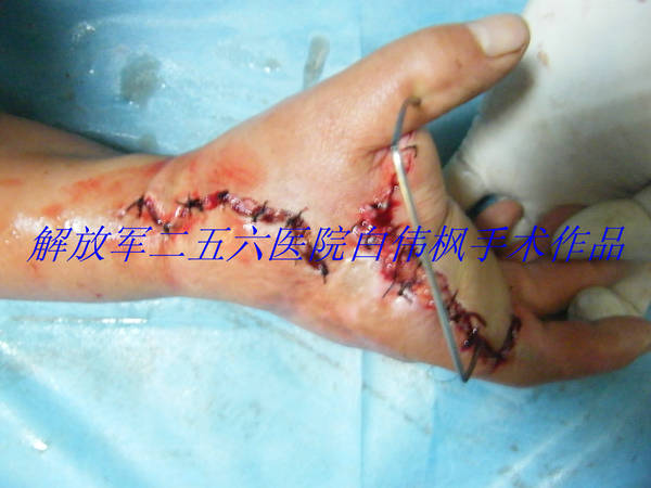 DSCF9387.JPG