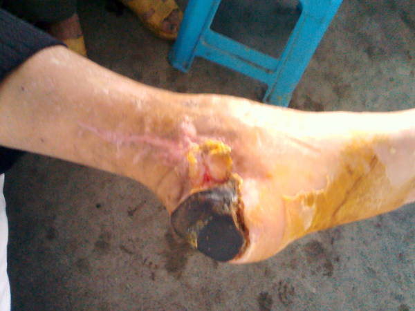IMG_20111014_083652.jpg