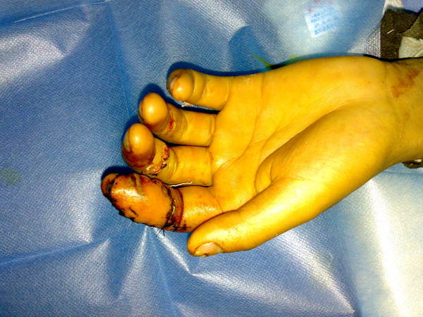 20100131641.jpg