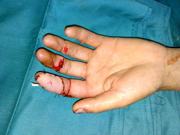 20100127638.jpg