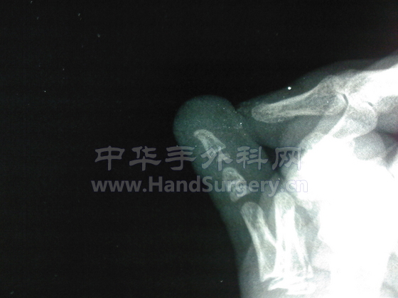 SPM_A0146.jpg