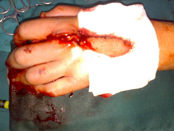 20100605747.jpg