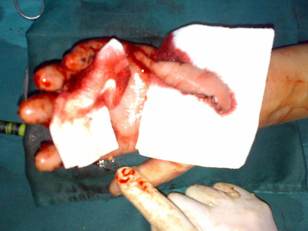 20100605746.jpg