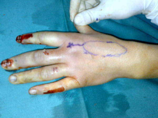 20100605744.jpg
