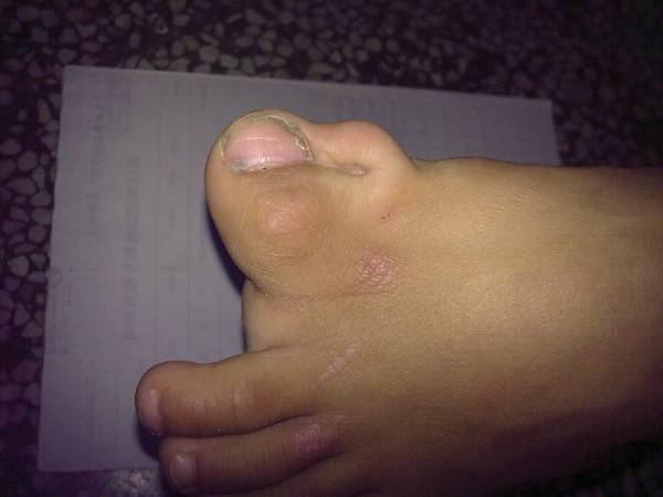 照片