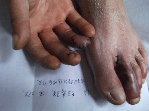 手外照片 137.jpg