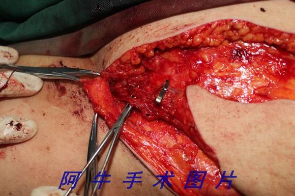 照片 175[1].jpg