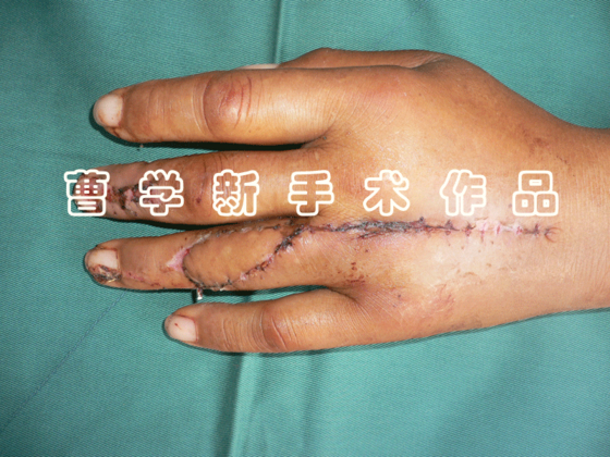 3.gif