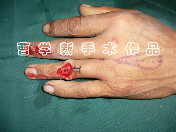 1.gif