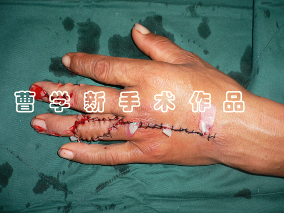 2.gif