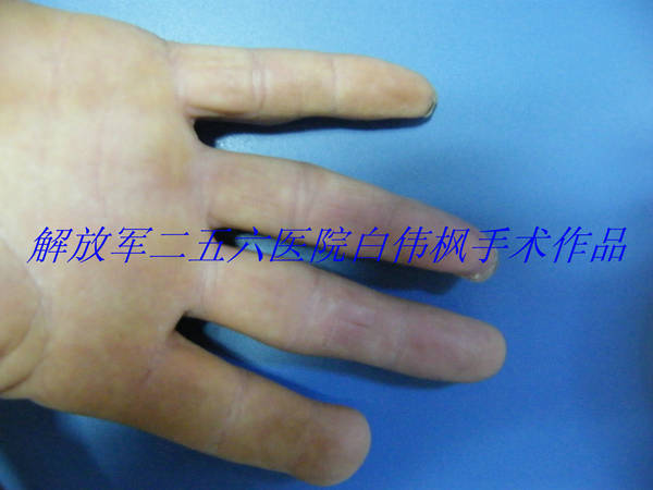DSCF9515.JPG