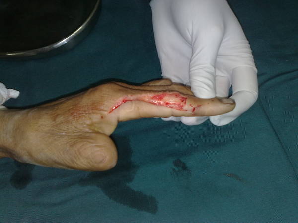 201106251180.jpg