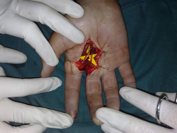 201108031256.jpg