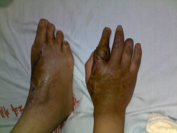 20111114048.jpg