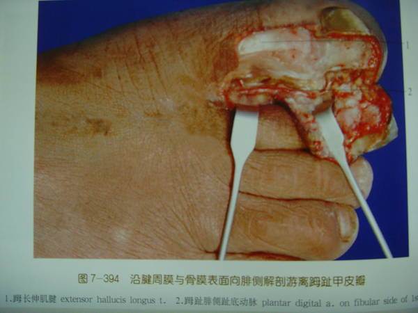 SNV34896.JPG