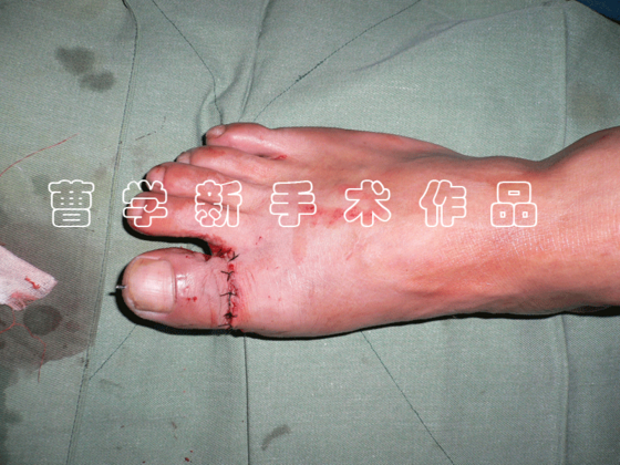 2.gif