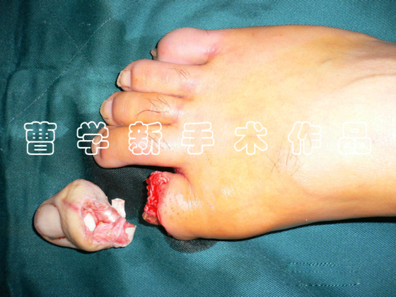 ZHI1.gif