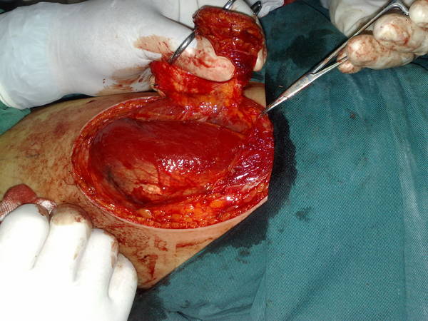 201111151402.jpg