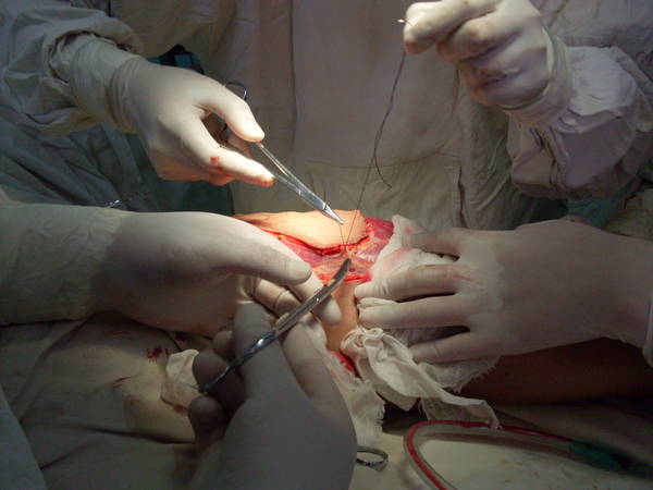 SDC12454.JPG